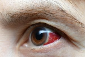 5 horrible diseases your eye doctor diagnoses first
