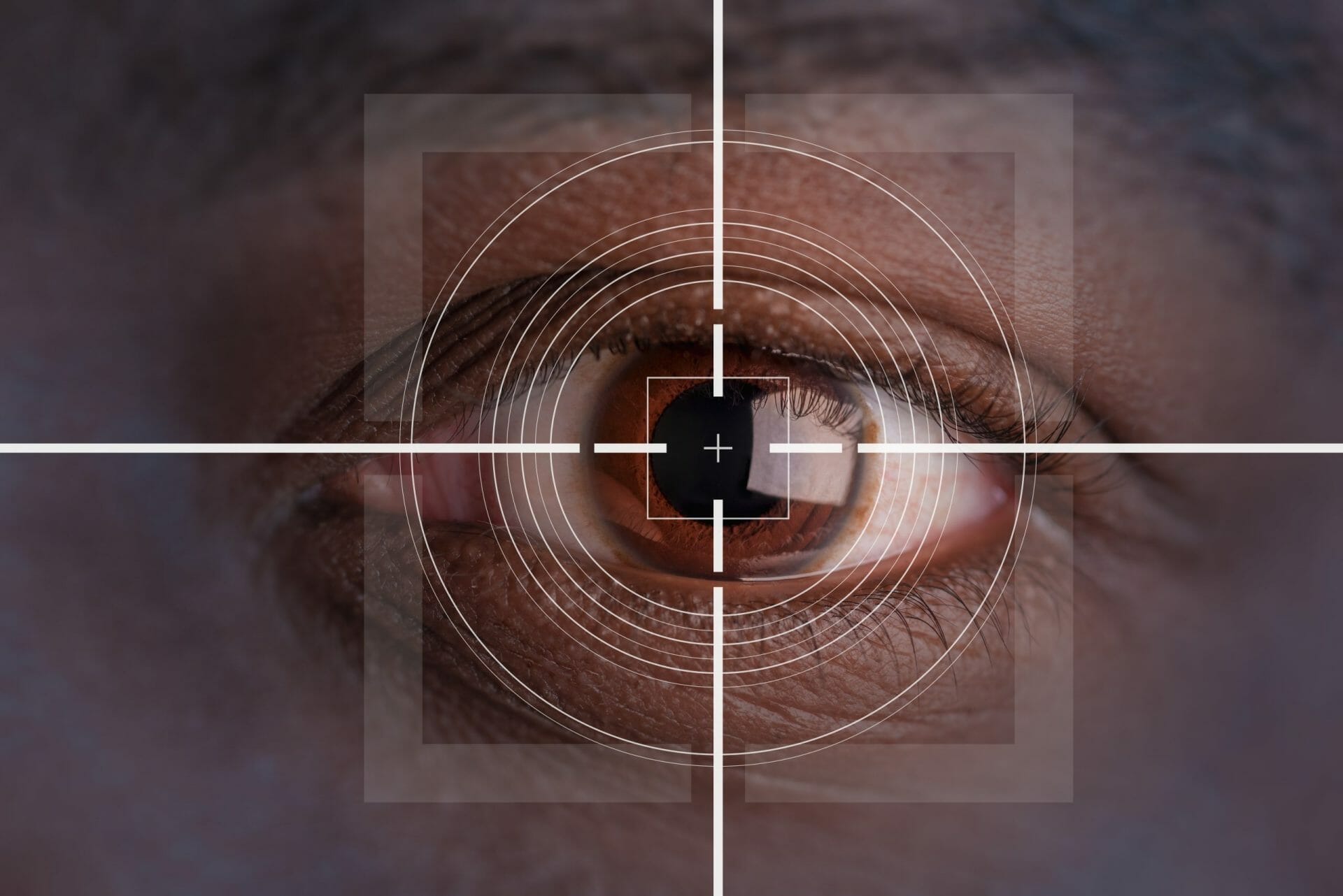 Monovision LASIK Eye Surgery Buy Contact Lenses in Pakistan Lenspk